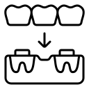 dental bridge