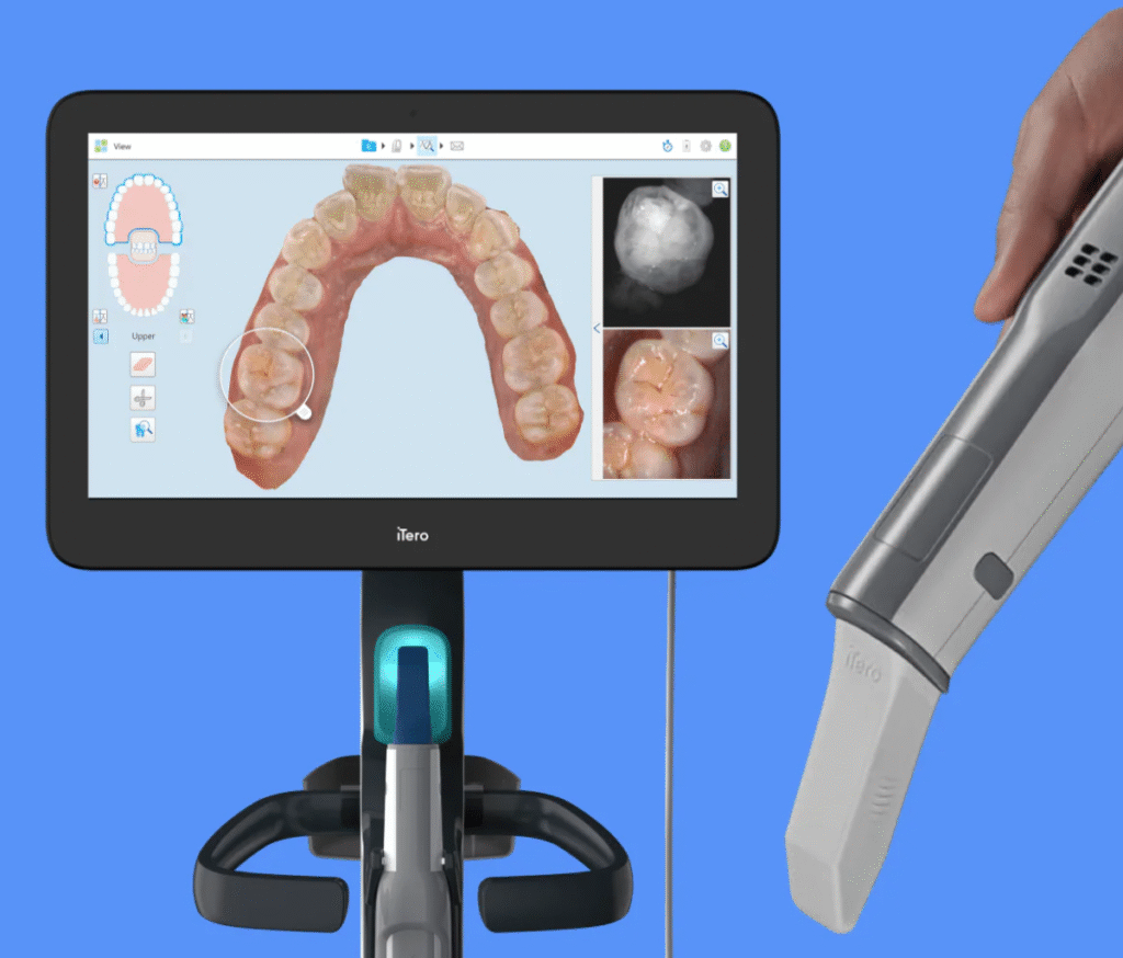 digital smile preview for Invisalign
