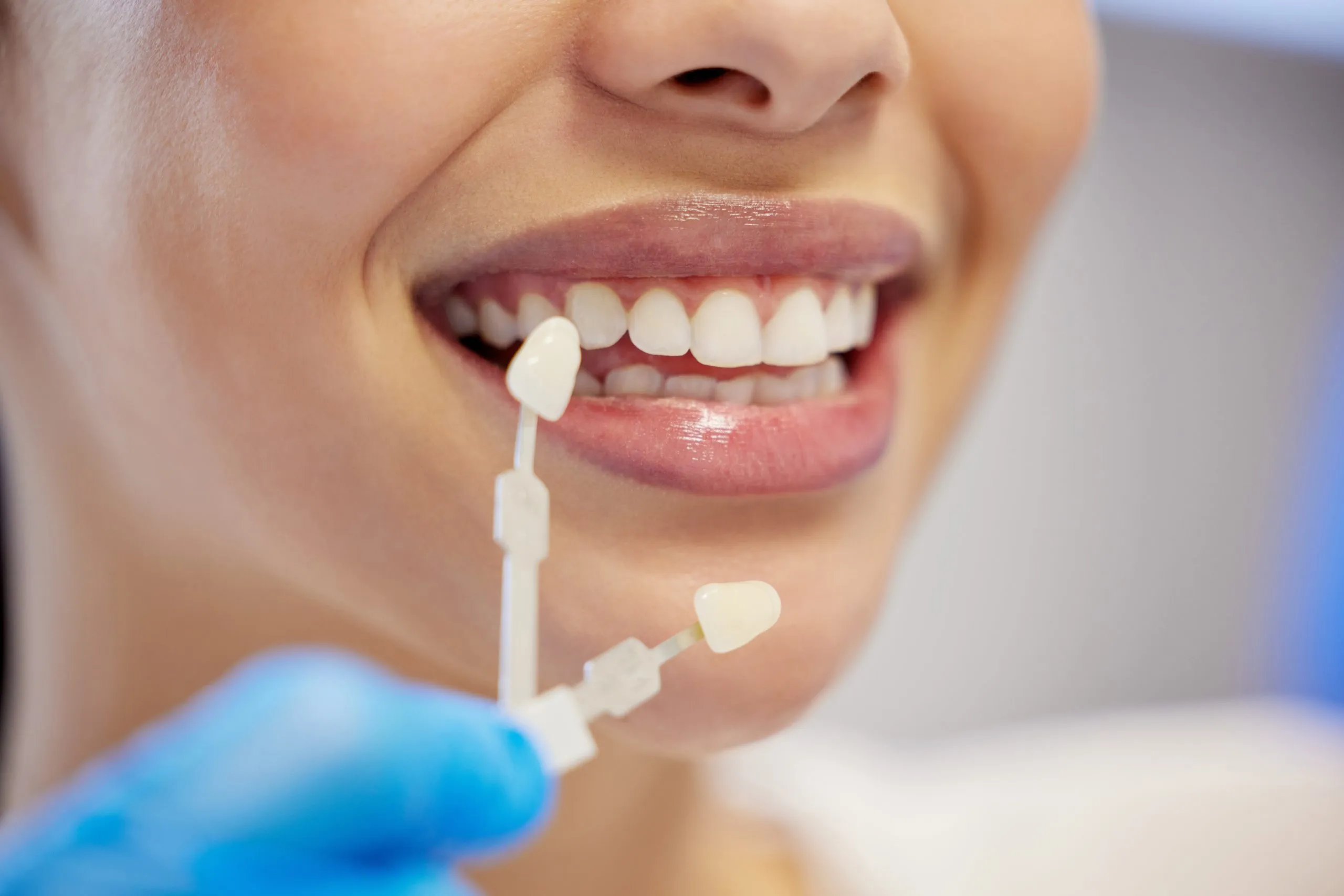 porcelain veneers near me
