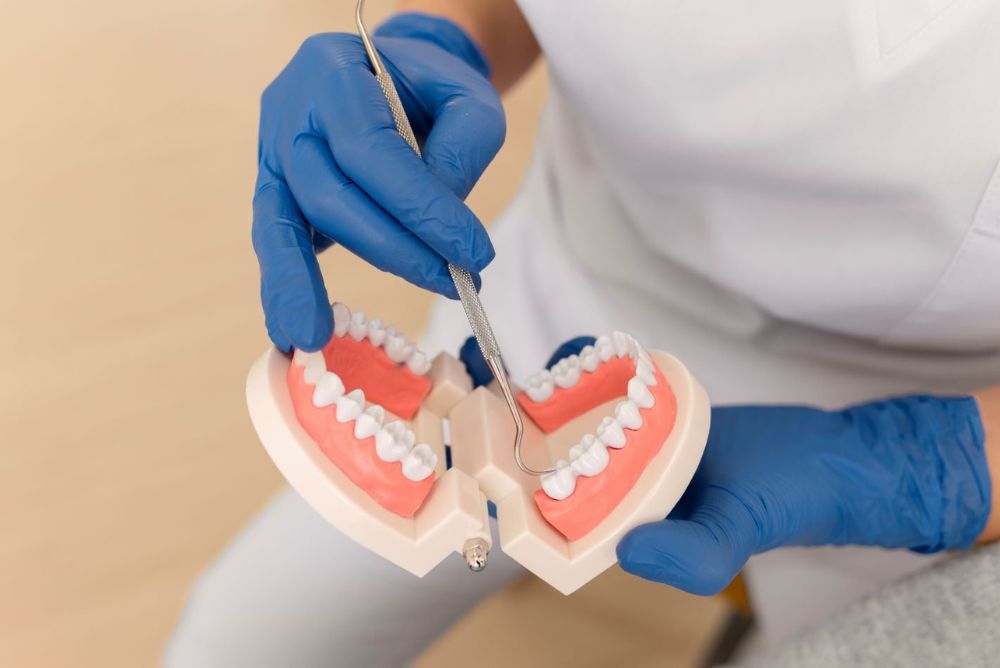 Dental Crowns